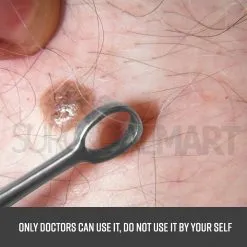 fox-dermal-curette-dermatology-instruments-surgicalmart
